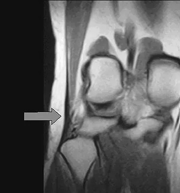 General Orthopedics Board Review 2026: High-Yield MCQs (Set 12) - Figure 79