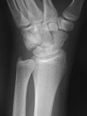 General Orthopedics Board Review 2026: High-Yield MCQs (Set 12) - Figure 8