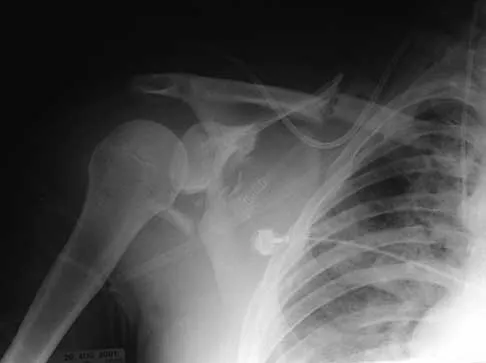 General Orthopedics Board Review 2026: High-Yield MCQs (Set 12) - Figure 80