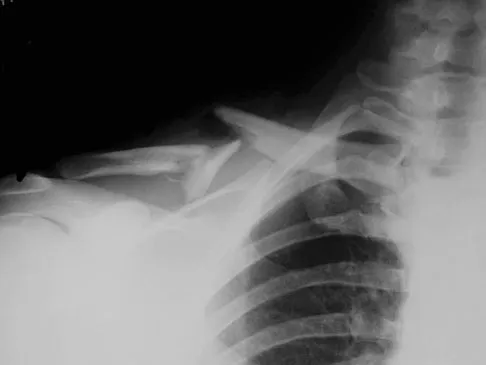 General Orthopedics Board Review 2026: High-Yield MCQs (Set 12) - Figure 81