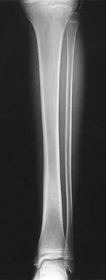 General Orthopedics Board Review 2026: High-Yield MCQs (Set 12) - Figure 85