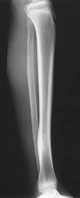 General Orthopedics Board Review 2026: High-Yield MCQs (Set 12) - Figure 86