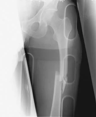 General Orthopedics Board Review 2026: High-Yield MCQs (Set 12) - Figure 91