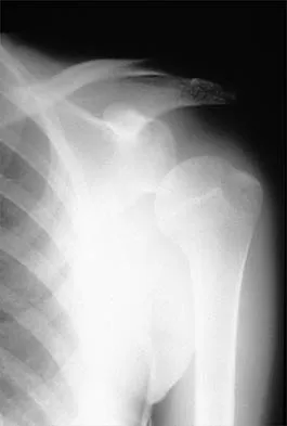 General Orthopedics Board Review 2026: High-Yield MCQs (Set 12) - Figure 93