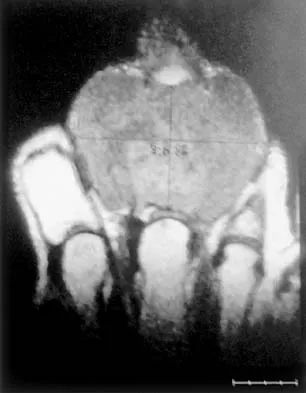 General Orthopedics Board Review 2026: High-Yield MCQs (Set 12) - Figure 96