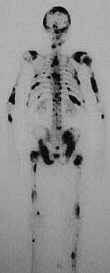 General Orthopedics 2026 Practice Questions: Set 13 (Solved) - Figure 1