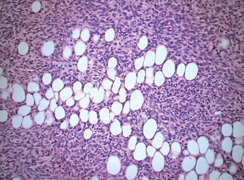 General Orthopedics 2026 Practice Questions: Set 13 (Solved) - Figure 14