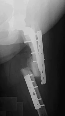 General Orthopedics 2026 Practice Questions: Set 13 (Solved) - Figure 15