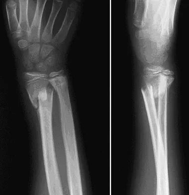 General Orthopedics 2026 Practice Questions: Set 13 (Solved) - Figure 24