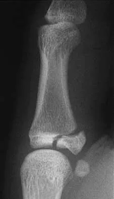 General Orthopedics 2026 Practice Questions: Set 13 (Solved) - Figure 25