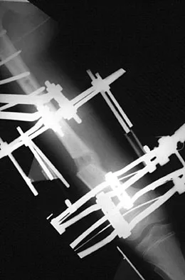 General Orthopedics 2026 Practice Questions: Set 13 (Solved) - Figure 27