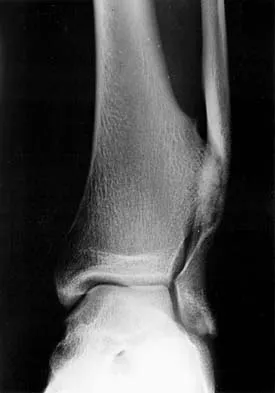 General Orthopedics 2026 Practice Questions: Set 13 (Solved) - Figure 32