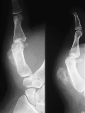 General Orthopedics 2026 Practice Questions: Set 13 (Solved) - Figure 35