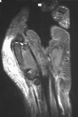 General Orthopedics 2026 Practice Questions: Set 13 (Solved) - Figure 36