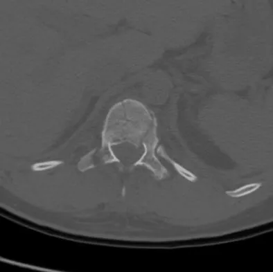 General Orthopedics 2026 Practice Questions: Set 13 (Solved) - Figure 4