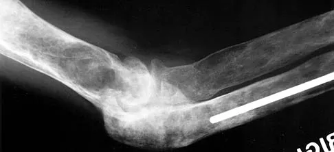 General Orthopedics 2026 Practice Questions: Set 13 (Solved) - Figure 40