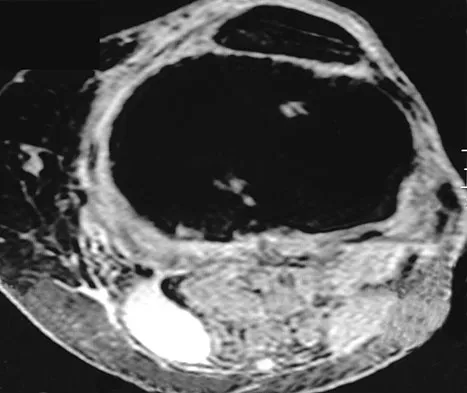 General Orthopedics 2026 Practice Questions: Set 13 (Solved) - Figure 47