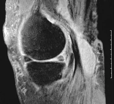 General Orthopedics 2026 Practice Questions: Set 13 (Solved) - Figure 48