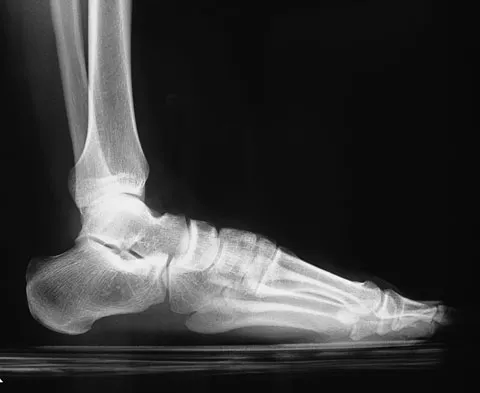 General Orthopedics 2026 Practice Questions: Set 13 (Solved) - Figure 49