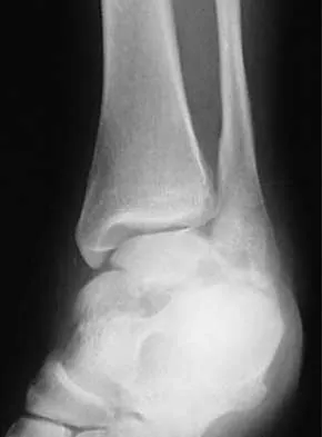 General Orthopedics 2026 Practice Questions: Set 13 (Solved) - Figure 54