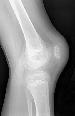 General Orthopedics 2026 Practice Questions: Set 13 (Solved) - Figure 57