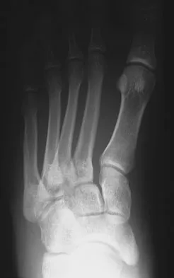 General Orthopedics 2026 Practice Questions: Set 13 (Solved) - Figure 64