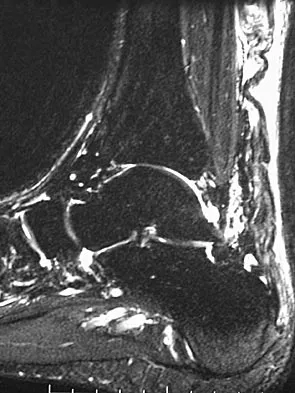 General Orthopedics 2026 Practice Questions: Set 13 (Solved) - Figure 69