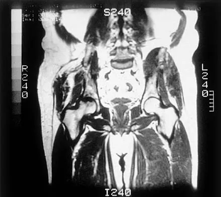 General Orthopedics 2026 Practice Questions: Set 13 (Solved) - Figure 7
