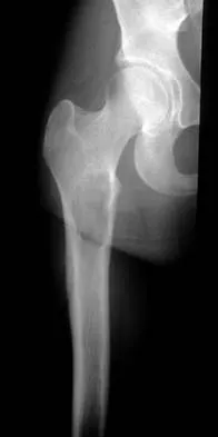 General Orthopedics 2026 Practice Questions: Set 13 (Solved) - Figure 72