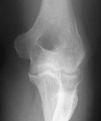 General Orthopedics 2026 Practice Questions: Set 13 (Solved) - Figure 75