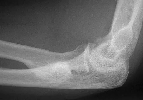 General Orthopedics 2026 Practice Questions: Set 13 (Solved) - Figure 76