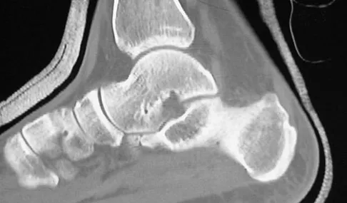 General Orthopedics 2026 Practice Questions: Set 13 (Solved) - Figure 78
