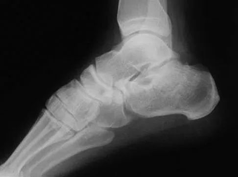 General Orthopedics 2026 Practice Questions: Set 13 (Solved) - Figure 83