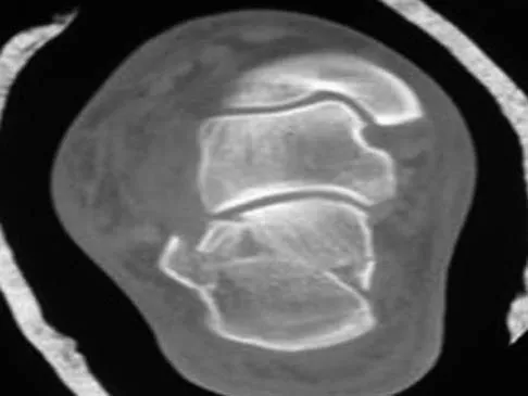 General Orthopedics 2026 Practice Questions: Set 13 (Solved) - Figure 84