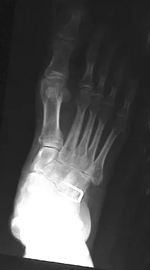 General Orthopedics 2026 Practice Questions: Set 13 (Solved) - Figure 91