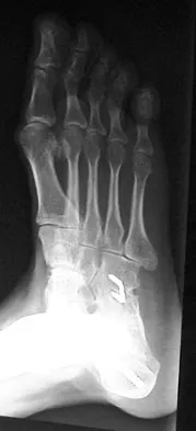 General Orthopedics 2026 Practice Questions: Set 13 (Solved) - Figure 92