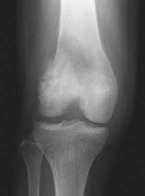 General Orthopedics Board Review 2026: High-Yield MCQs (Set 14) - Figure 101