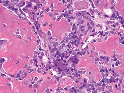 General Orthopedics Board Review 2026: High-Yield MCQs (Set 14) - Figure 103