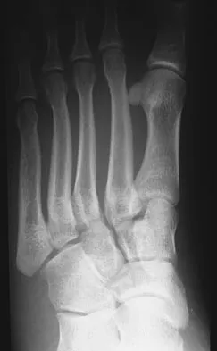 General Orthopedics Board Review 2026: High-Yield MCQs (Set 14) - Figure 12