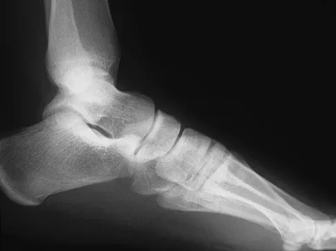 General Orthopedics Board Review 2026: High-Yield MCQs (Set 14) - Figure 13