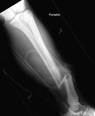 General Orthopedics Board Review 2026: High-Yield MCQs (Set 14) - Figure 26