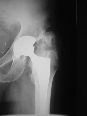 General Orthopedics Board Review 2026: High-Yield MCQs (Set 14) - Figure 28