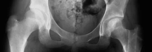 General Orthopedics Board Review 2026: High-Yield MCQs (Set 14) - Figure 30