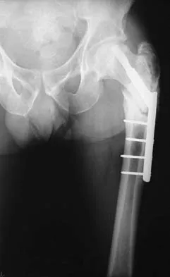 General Orthopedics Board Review 2026: High-Yield MCQs (Set 14) - Figure 4