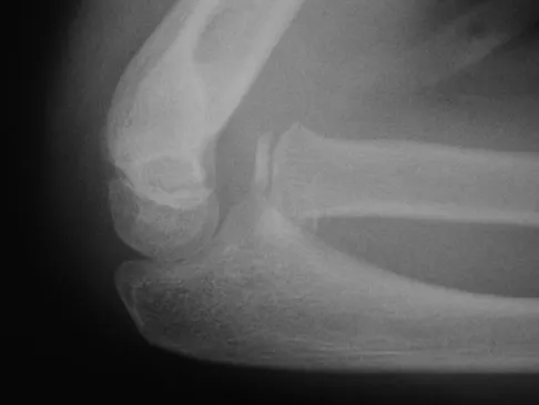 General Orthopedics Board Review 2026: High-Yield MCQs (Set 14) - Figure 43