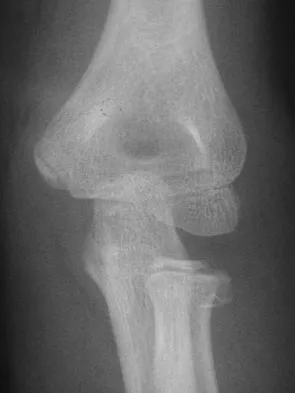 General Orthopedics Board Review 2026: High-Yield MCQs (Set 14) - Figure 44