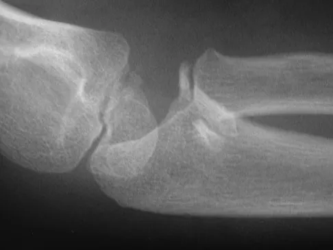 General Orthopedics Board Review 2026: High-Yield MCQs (Set 14) - Figure 45