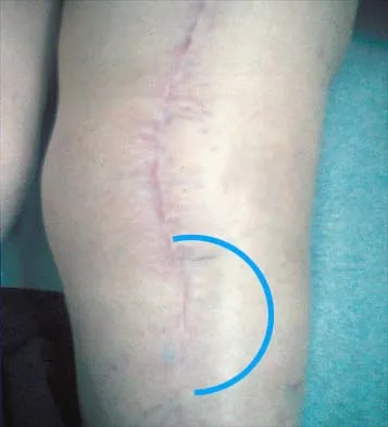 General Orthopedics Board Review 2026: High-Yield MCQs (Set 14) - Figure 50