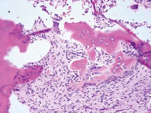 General Orthopedics Board Review 2026: High-Yield MCQs (Set 14) - Figure 53