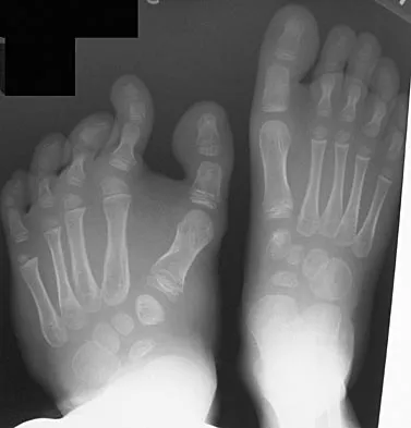 General Orthopedics Board Review 2026: High-Yield MCQs (Set 14) - Figure 55